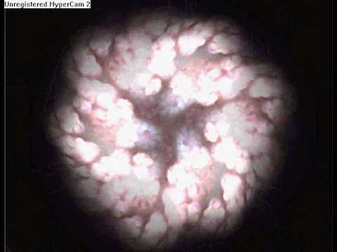 Osom - Xaggittariuss