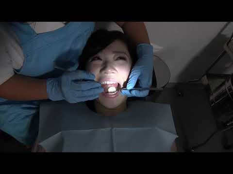 中国:ロボット歯科医による治療を受けるボランティア