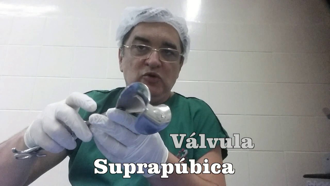 AFASTADORES CIRÚRGICOS