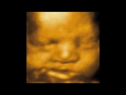 3D 4D Ultrasound by 1st Glimpse Inc. 3D/4D Ultrasound in Brooklyn New York