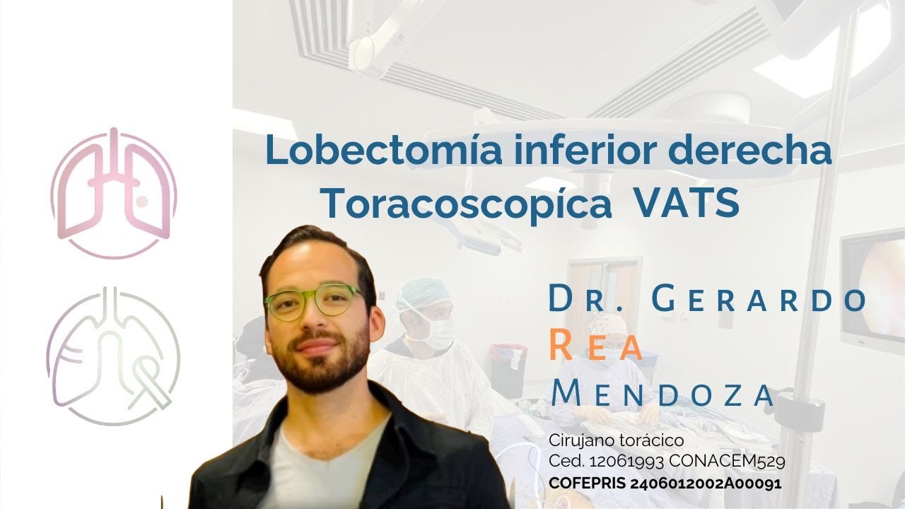 Gerardo Rea Mendoza-49