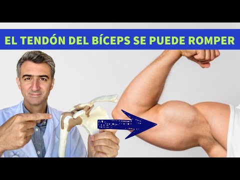 Lesiones del tendón del Bíceps del Hombro: Causas y Tratamiento
