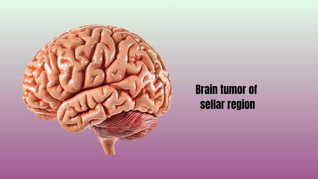 David Tafur Muñoz-2495