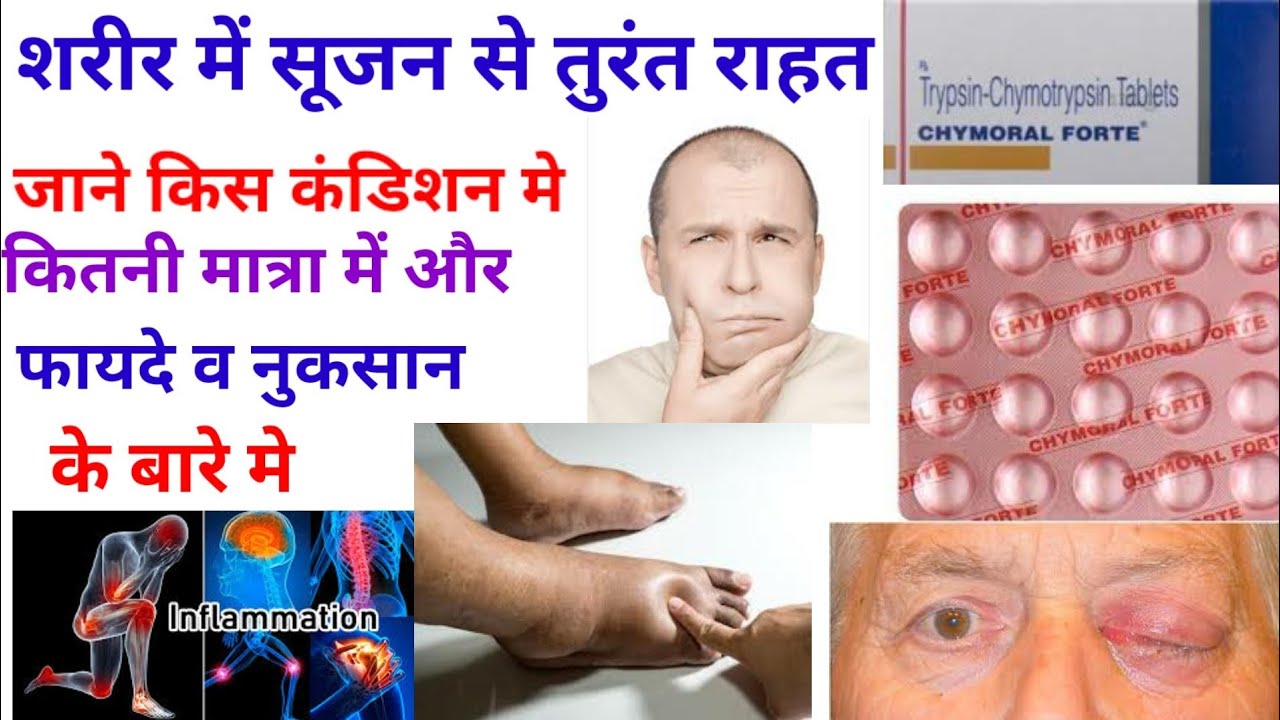 Watch video Chymoral forte tablet ll use, benefits and side effects Now Chymoral forte tablet ll use, benefits and side effects