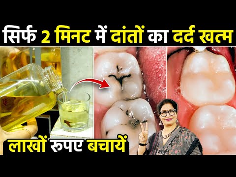 एक कप गार्गल कर लो सोने से पहले - कीड़ा लगे, पीले, खोखले दाँत फिर से नए जैसे | Tooth Decay Treatment