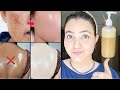 घर पर बनाये Market से बेहतर 100 Natural Powerful Body Wash SKIN Brig