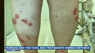 Miniatura do vídeo