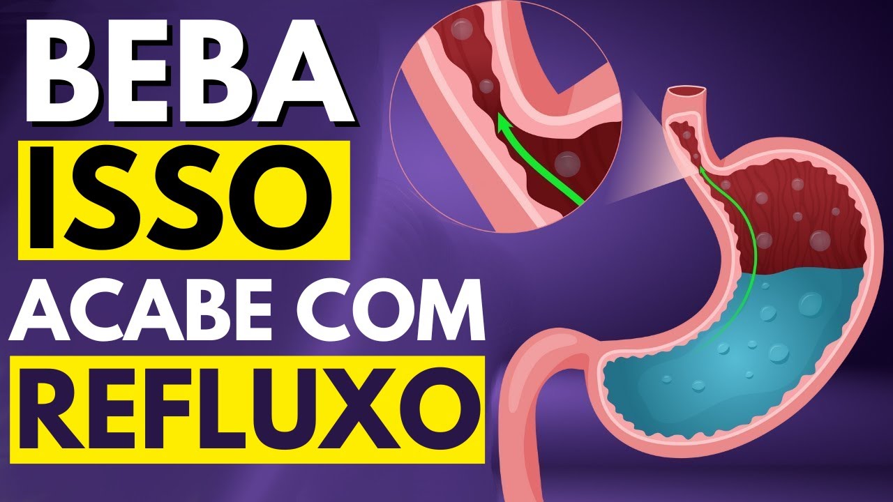 Melhores Bebidas Para Parar O Refluxo Ácido