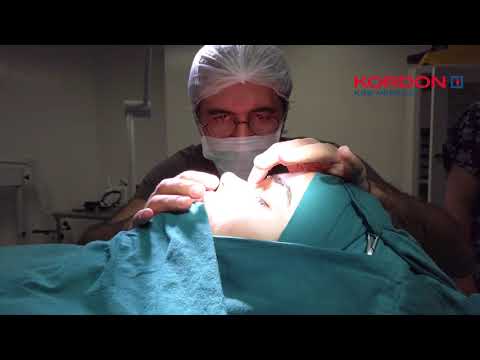 Op. Dr. Can Ercan - Ameliyat Videosu