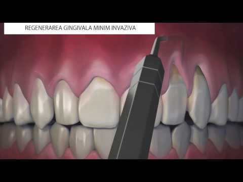 tratament articular hunchun