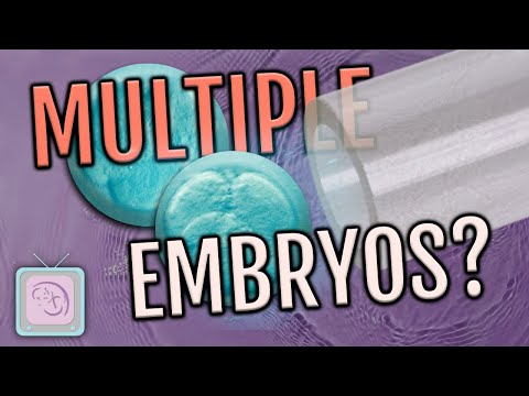 IVF Tips - Is it better to transfer 1 embryo or 2?