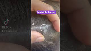Tiny Louse Trying to Run 🏃‍♂️ Away l Lice Removal Service @Thelousegirl