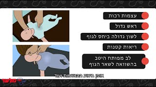 החייאת תינוקות | מלער קורס עזרה ראשונה