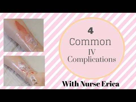 Common Peripheral IV Complications