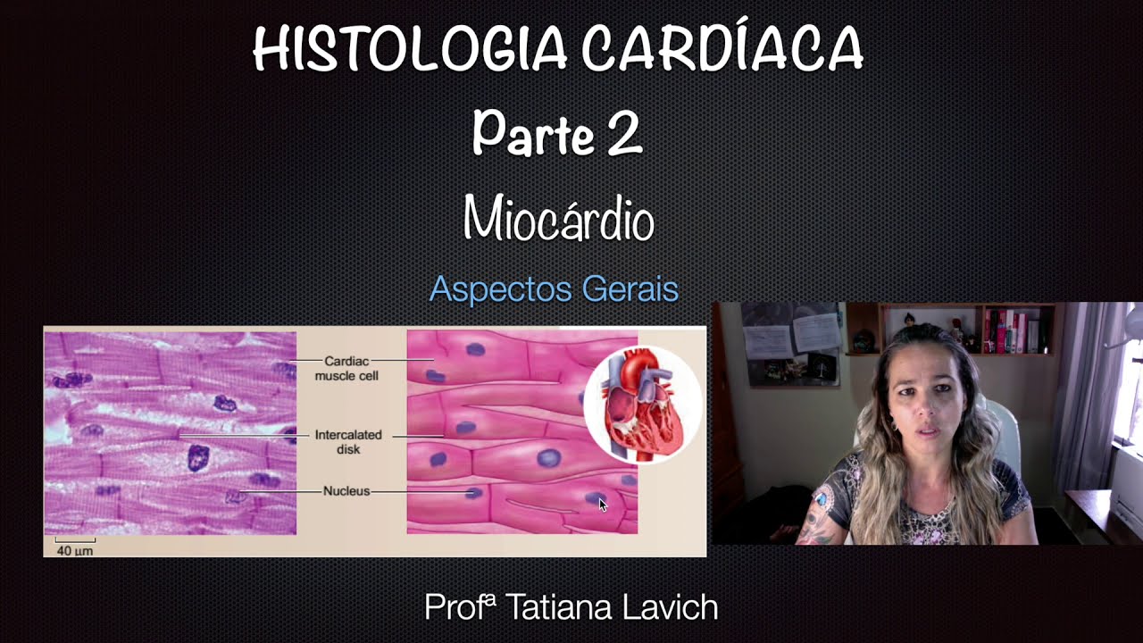 Histologia Cardíaca - Miocárdio