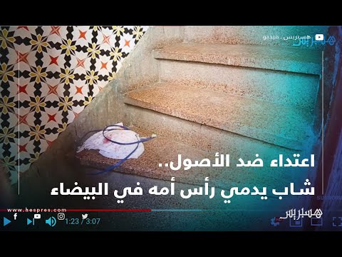 اعتداء ضد الأصول.. شاب يدمي رأس أمه في البيضاء