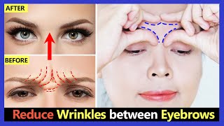 How to Get rid frown lines, Reduce Wrinkles between eyebrows Naturally | Face Yoga & Massage
