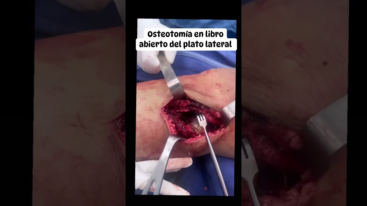 Helberth Augusto González Rico-5