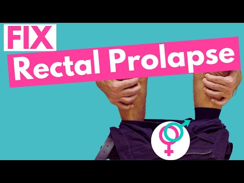 How to Stop Your Rectal Prolapse Worsening | Physiotherapy