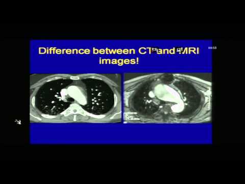 CARDIO RADIOLOGY CME PART 2