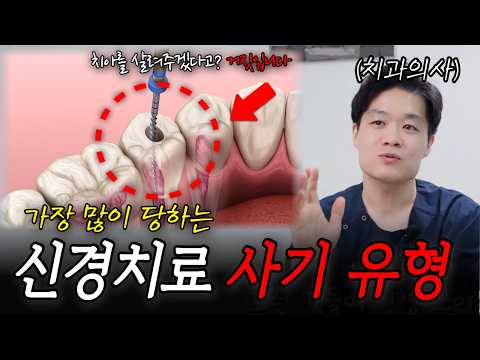 신경치료 과잉진료, 장담컨데 이거는 90%가 모르고 당할 겁니다!