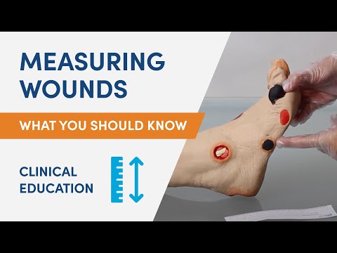 Measuring Wounds | Woundle Education