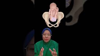 Download lagu Penjelasan Bayi Lahir Sungsang mp3