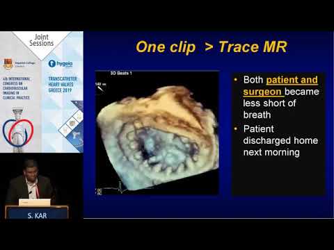 S  Kar | Percutaneous mitral repair after failed open surgery