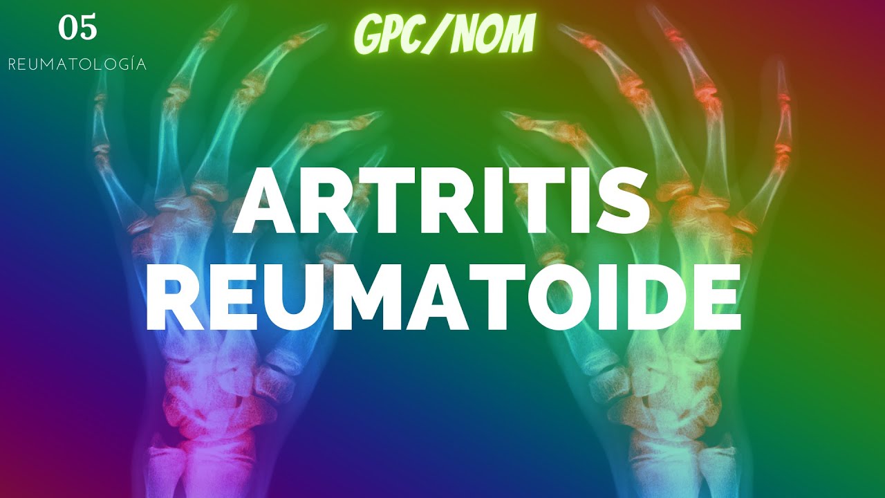 Artritis reumatoide (A DETALLE) - ENARM