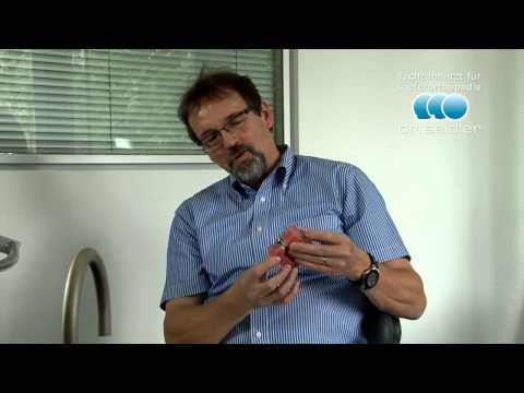 AdvanSync(TM) Teil 1: Die Erstannahme