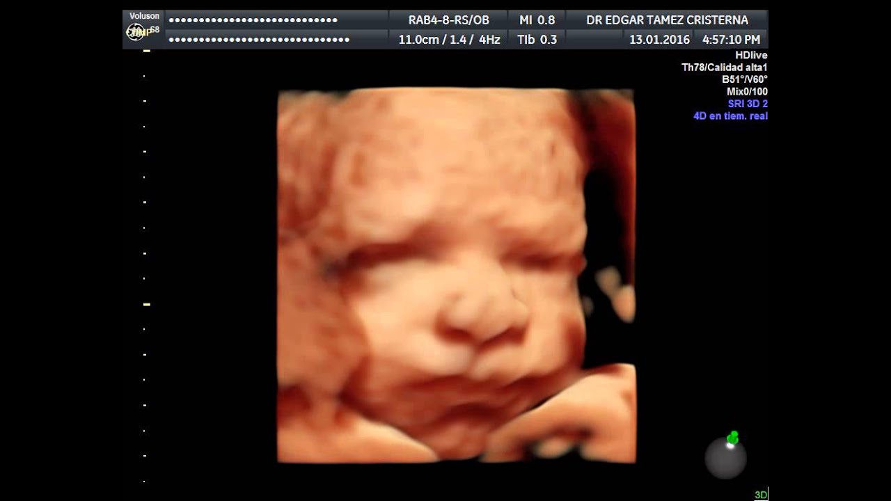 Edgar Alejandro Támez Cristerna-11