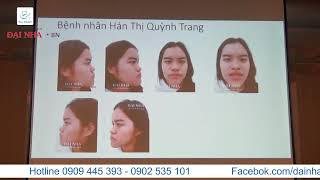Chỉnh nha offline: Bài 10 Phân tích ca lâm sàng bệnh nhân 4