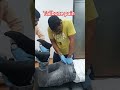 Tailbone Pain Treatment