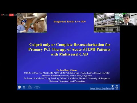 Culprit only or Complete Revascularization for Primary PCI in Acute STEMI with Multivessel CAD