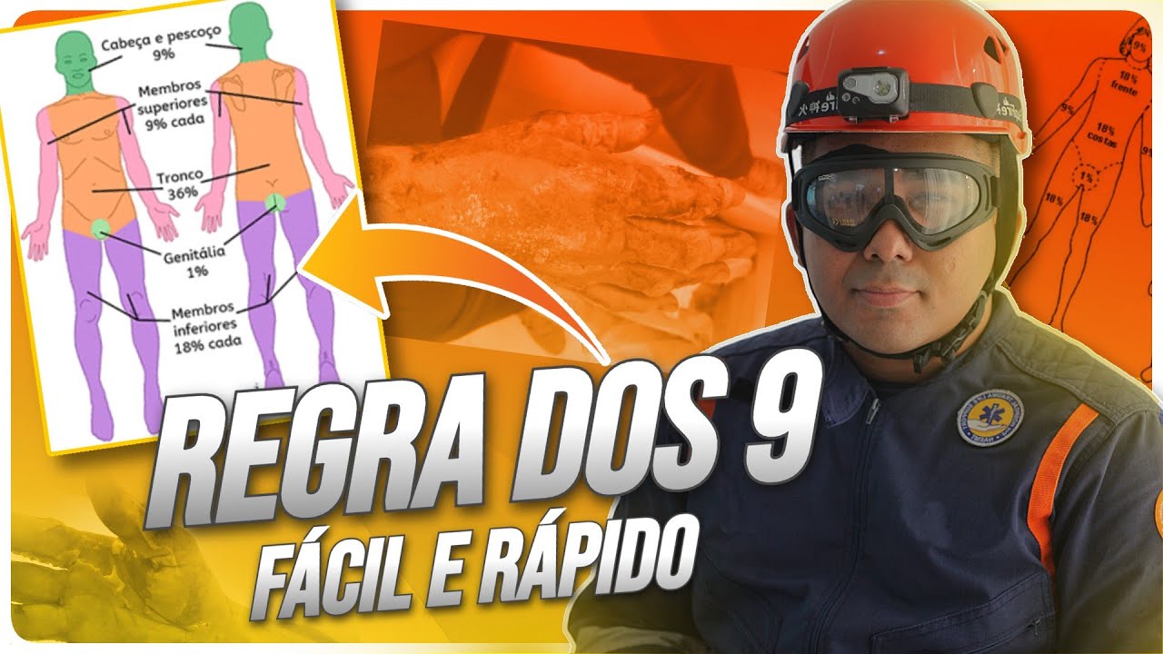 REGRA DOS 9 - APRENDA A CALCULAR A PORCENTAGEM DO CORPO QUEIMADO (FÁCIL E RÁPIDO)