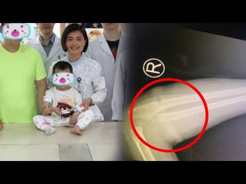 Mereka tidak khawatir tentang berat tambahan Adalah mungkin untuk menurunkan berat badan dengan menjalankan pada ski