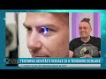 Control Medical 21 Video thumbnail