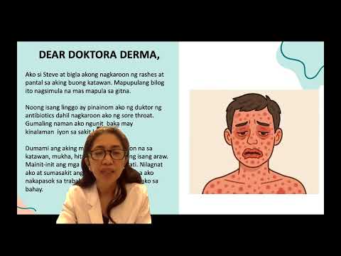 Balat Basics ni Doktora Derma: May SJS (Stevens-Johnson Syndrome) si Steve (by Dr Cecile C. Ocampo)