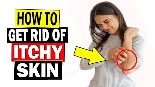How To Get Rid of Itchy Skin Fast || Home Remedies for Itchy Skin Treatment