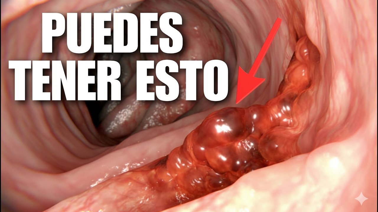 TE PUEDES MORIR de CÁNCER SI NO SABES ESTO