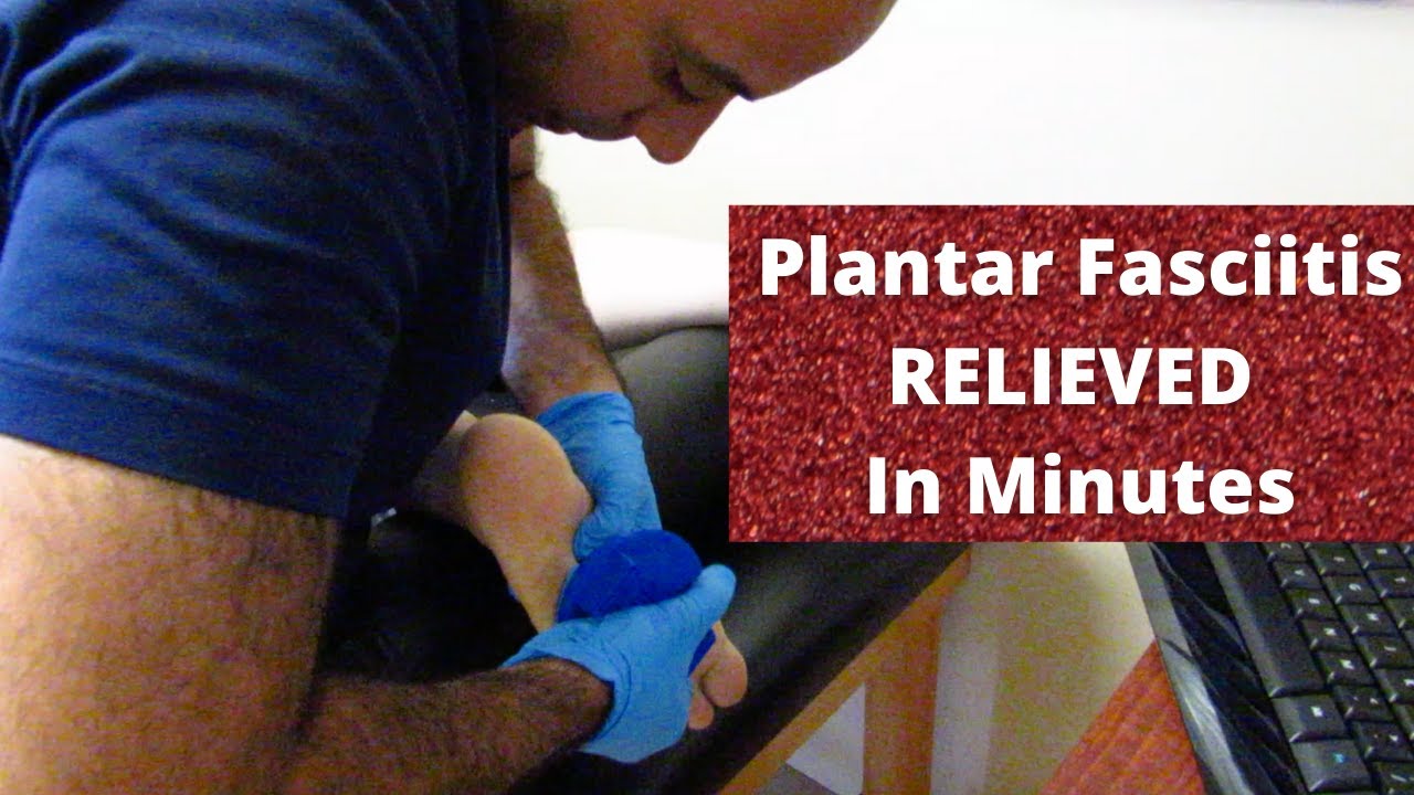 9 Months * Plantar Fasciitis * RELIEVED Before Your Eyes (REAL TREATMENT!!!)