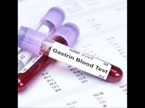 Serum Gastrin Assay Or Gastrin Blood Test ; Definition, Procedure, Purpose, Uses