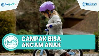 Kenali Dampak Campak pada Anak Bisa Tingkatkan Infeksi hingga Ancam Nyawa