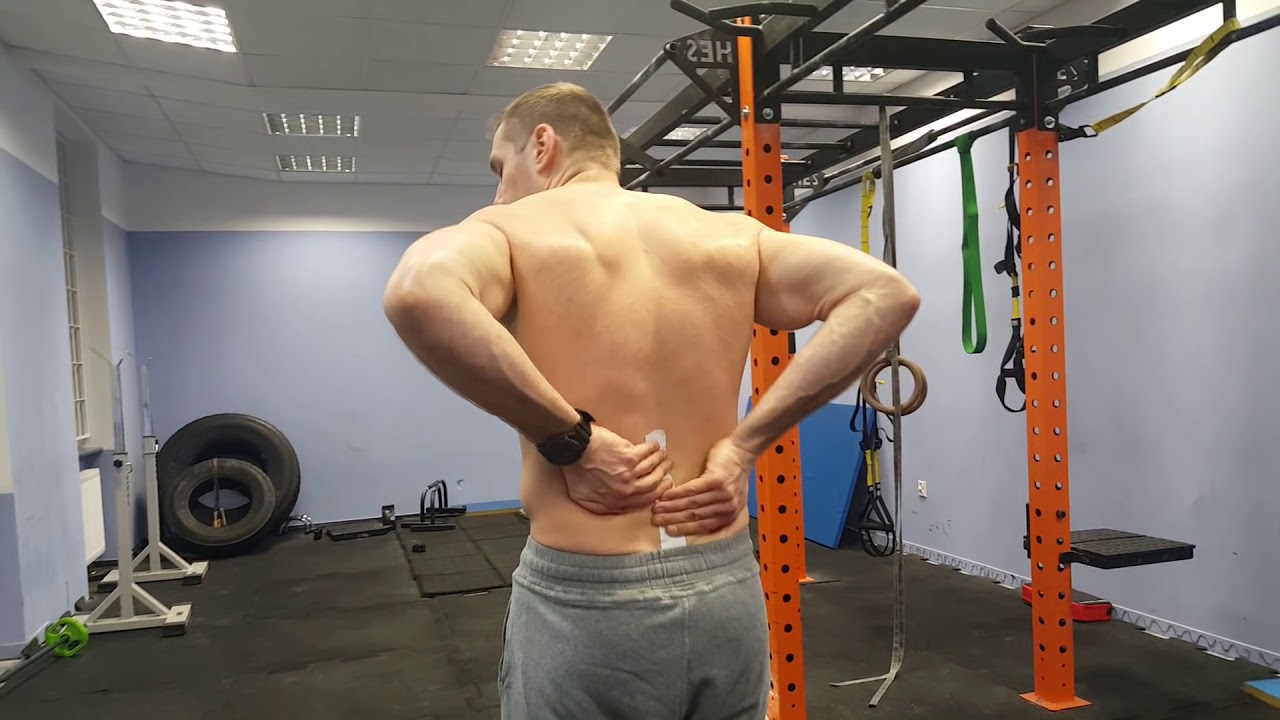 Przepuklina L5 - S1 - jak to naprawić 