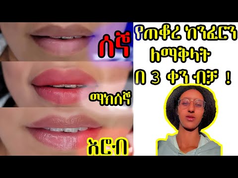 የጠቆረ ከንፈርን  ለማቅላትበ 3 ቀን ብቻ ! ቀላል ዘዴ | Home Remedies for Naturally Lighten Dark Lips | Ethiopia 2023