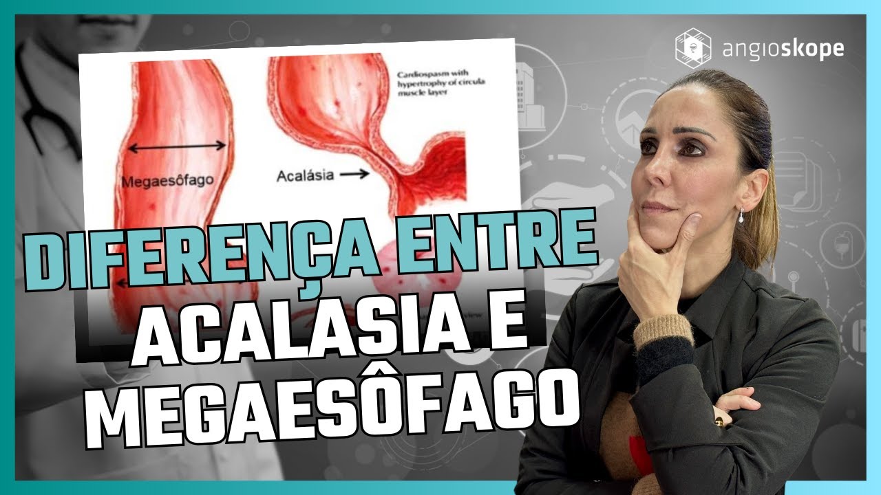 Diferença entre Acalasia e Megaesôfago - Clínica Angioskope
