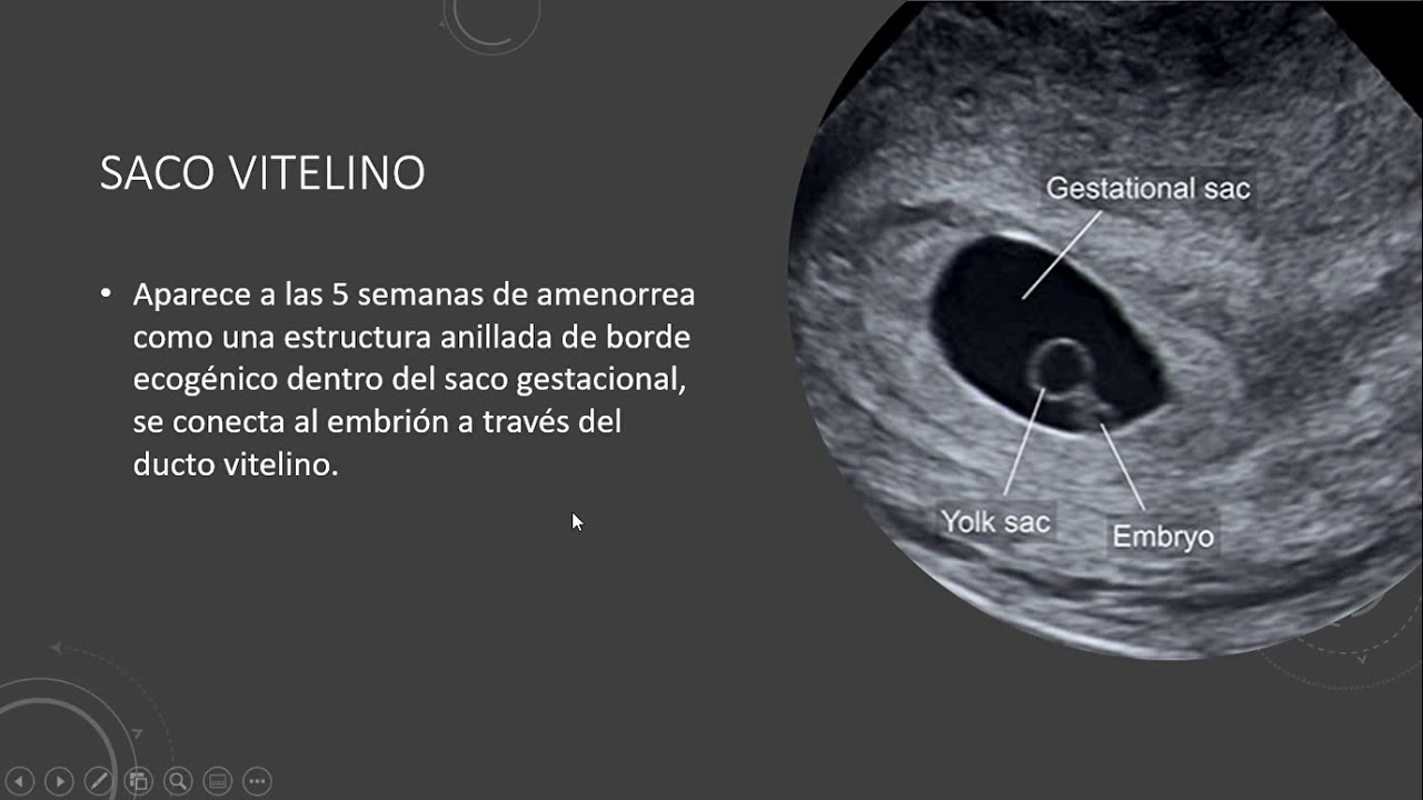 ECOGRAFIA EMBRIONARIA