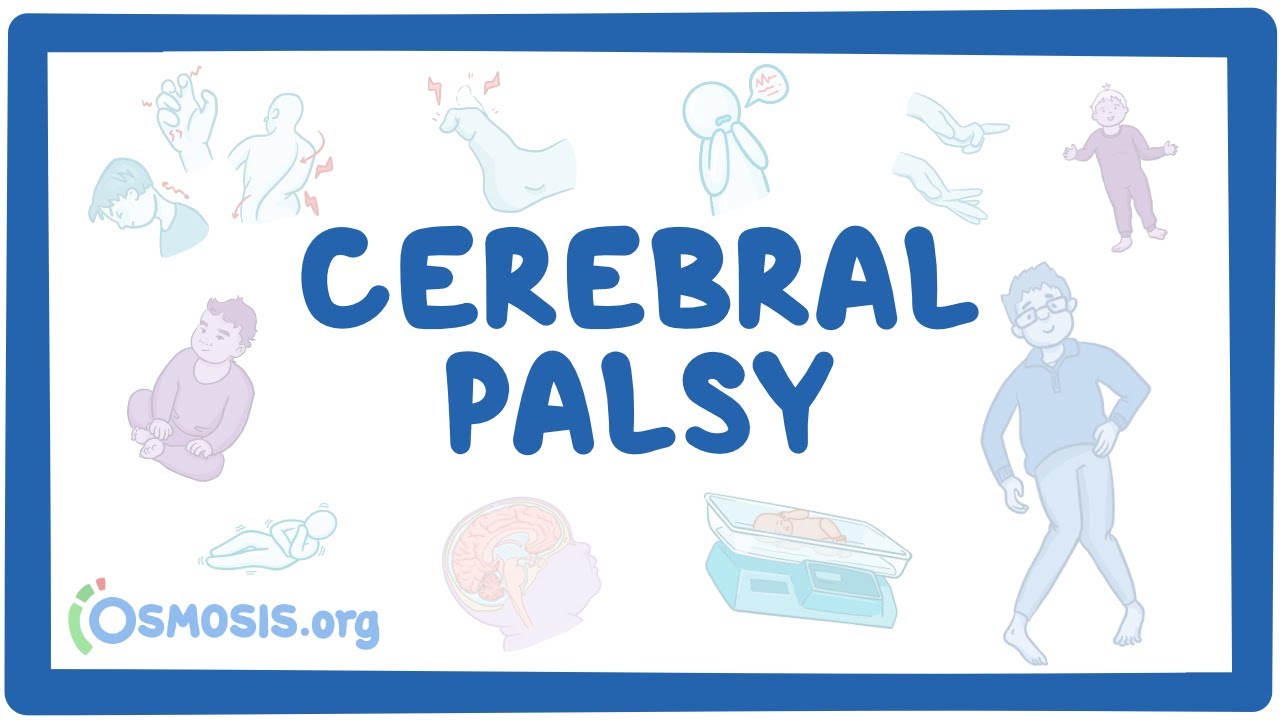 Cerebral palsy (CP) - causes, symptoms, diagnosis, treatment, pathology