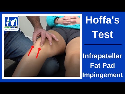 Quadriceps Repair 3 Weeks Post Op