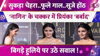 Download lagu Priyanka Chahar Choudhary's complexion changed, ruined due to Naagin 7, her face was destroyed! mp3 Download lagu Priyanka Chahar Choudhary's complexion changed, ruined due to Naagin 7, her face was destroyed! mp3